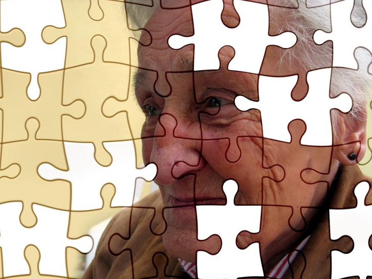 El alzhéimer es la forma más común de demencia El alzhéimer es la forma más común de demencia.