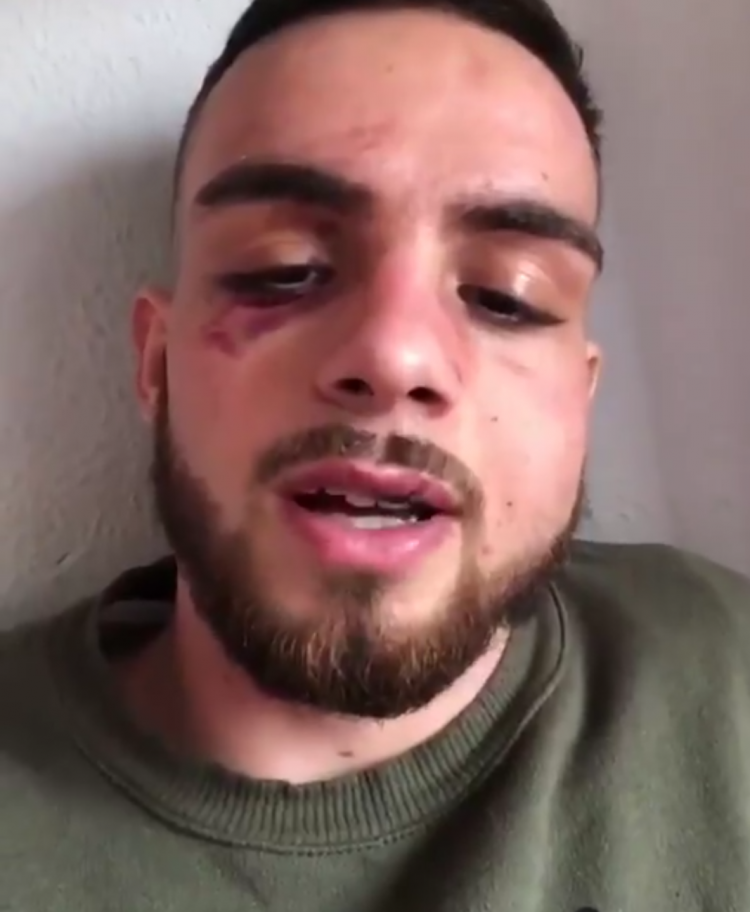 David Espinosa en una imagen en la que se aprecian aún las magulladuras en el rostro. David Espinosa en una imagen en la que se aprecian aún las magulladuras en el rostro.