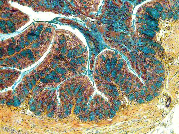 Imagen de un corte del intestino de un ratón afectado con enfermedad inflamatoria intestinal.