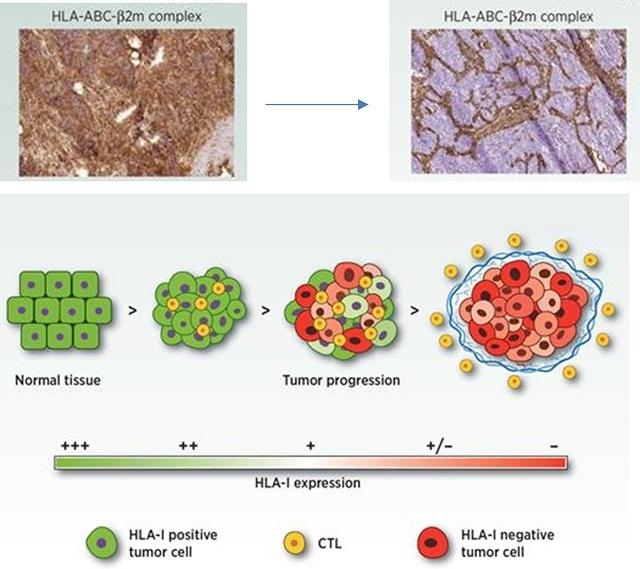 El estudio muestra cómo actúan los antígenos leucocitarios humanos de clase I (HLA-I).