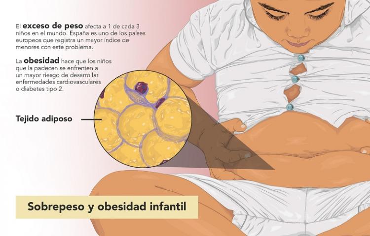 La obesidad infantil, un problema que se ha agravado en las últimas décadas.