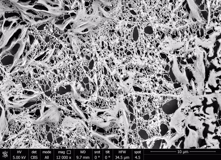 Detalle al microscopio de la regeneración ósea. 