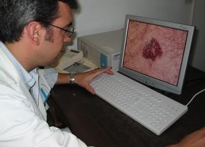 Un médico observa la imagen de un lunar en la piel. 