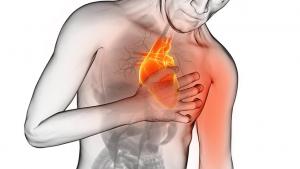 Mucha gente que sufre un ataque al corazón tarda mucho en pedir ayuda.