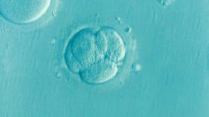 Imagen de un embrión.