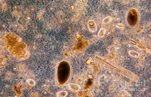 Imagen de un microbioma.